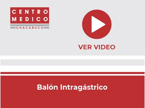 Miniatura del video: Balón intragástrico