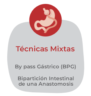 Técnicas mixtas: bypass gástrico y bipartición intestinal.