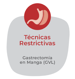 Técnicas restrictivas: gastrectomía en manga.